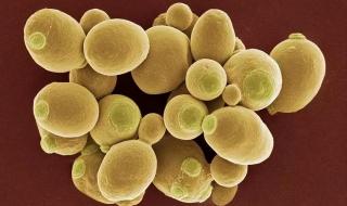 植物综合酶 植物综合酶